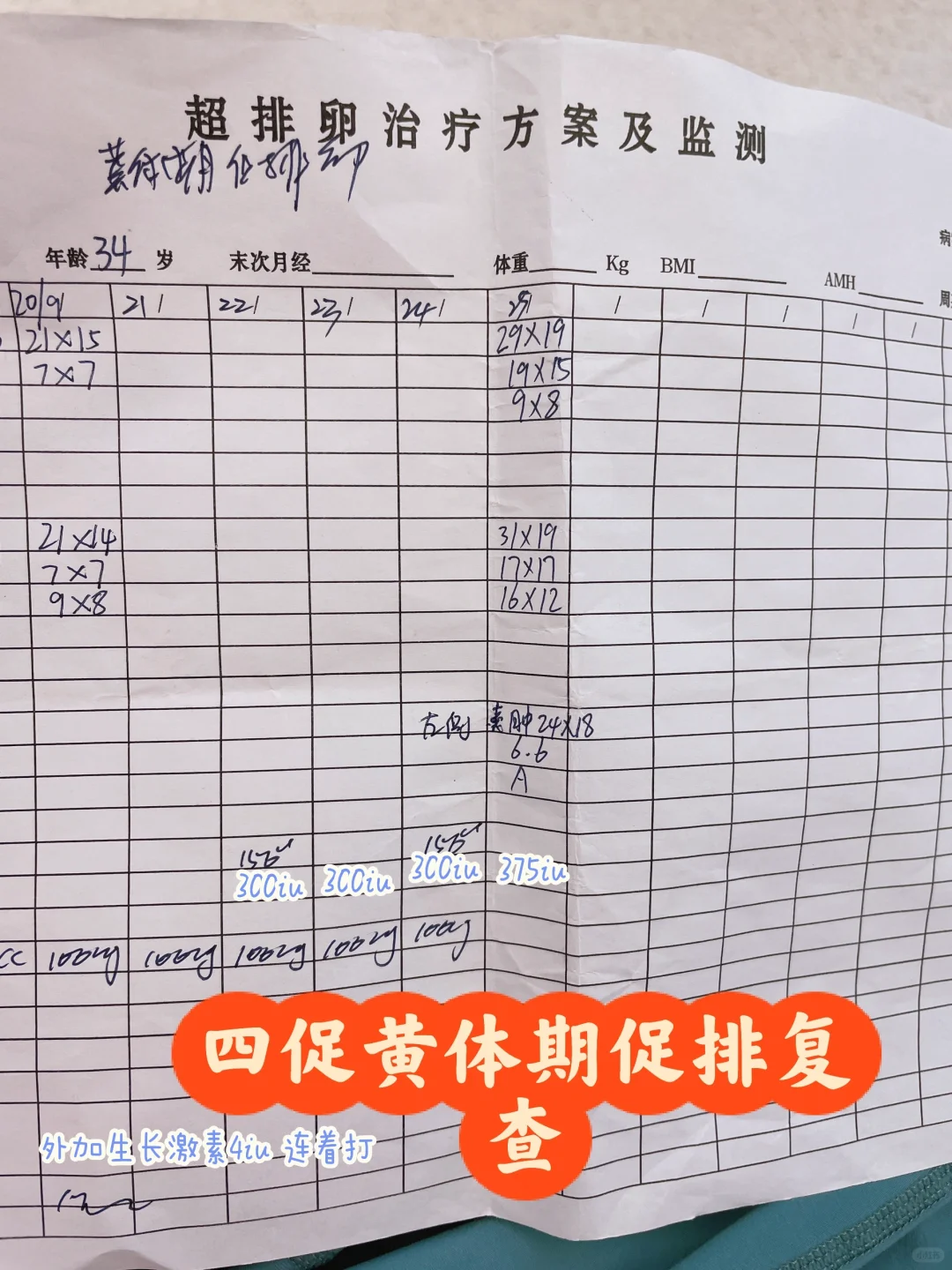 四促黄体期促排复查,长春供卵生殖中心